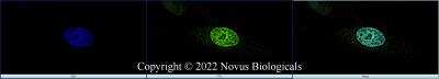 Immunocytochemistry/Immunofluorescence: ERR alpha/NR3B1 Antibody [DyLight 488] [NBP1-47254G] - HeLa cells were fixed in 4% paraformaldehyde for 10 minutes and permeabilized in 0.5% Triton X-100 in PBS for 5 minutes. The cells were incubated with ERR alpha/NR3B1 Antibody conjugated to DyLight 488 (NBP1-47254G) at 5 ug/ml for 1 hour at room temperature.  Nuclei were counterstained with DAPI (Blue).  Cells were imaged using a 100X objective and digitally deconvolved.